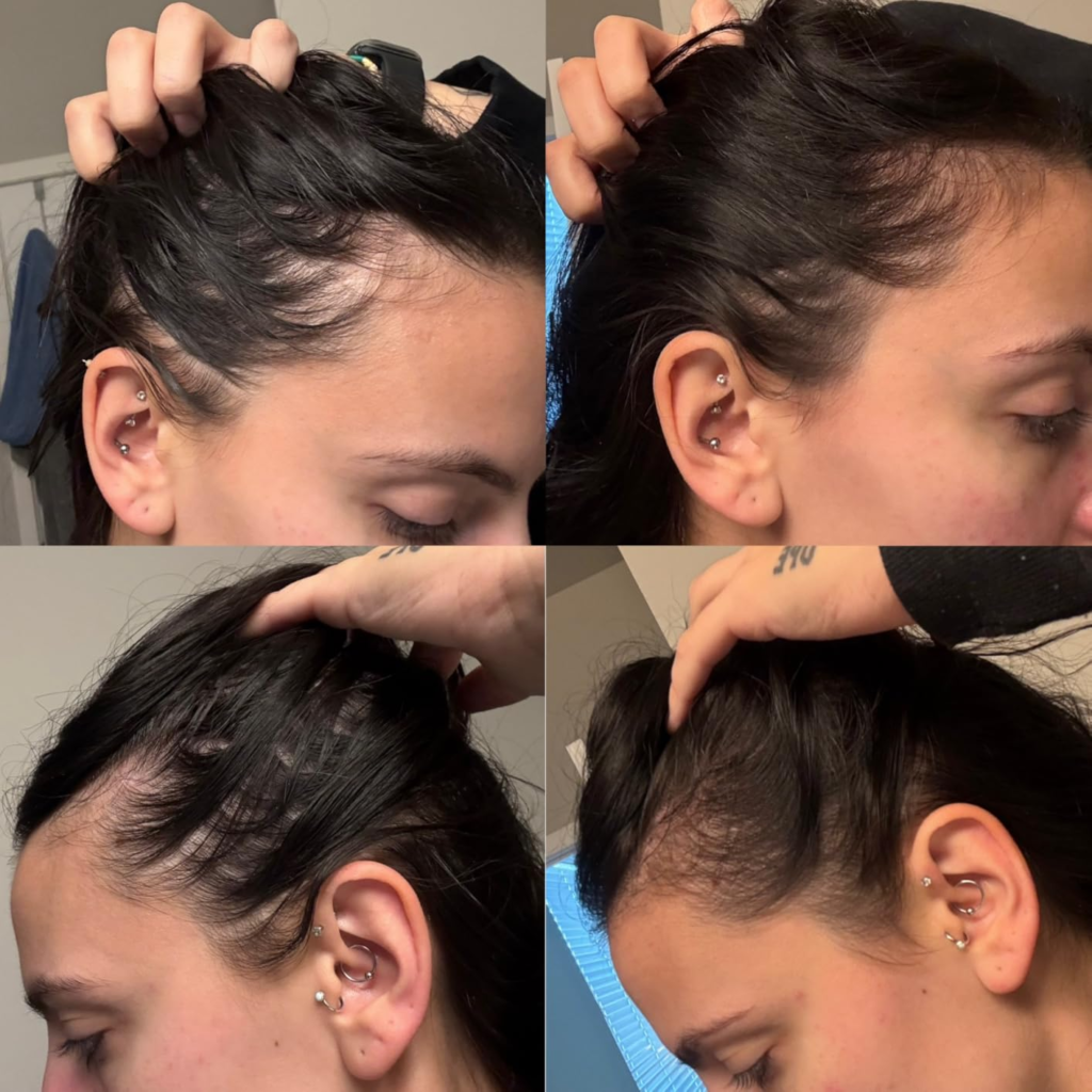 nutrafol reviews women